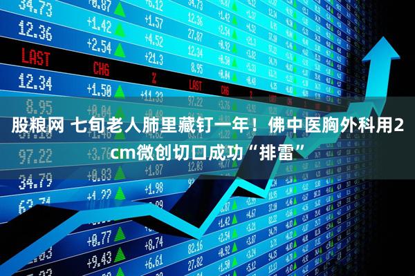 股粮网 七旬老人肺里藏钉一年！佛中医胸外科用2cm微创切口成功“排雷”